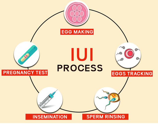 Intrauterine Insemination (IUI)